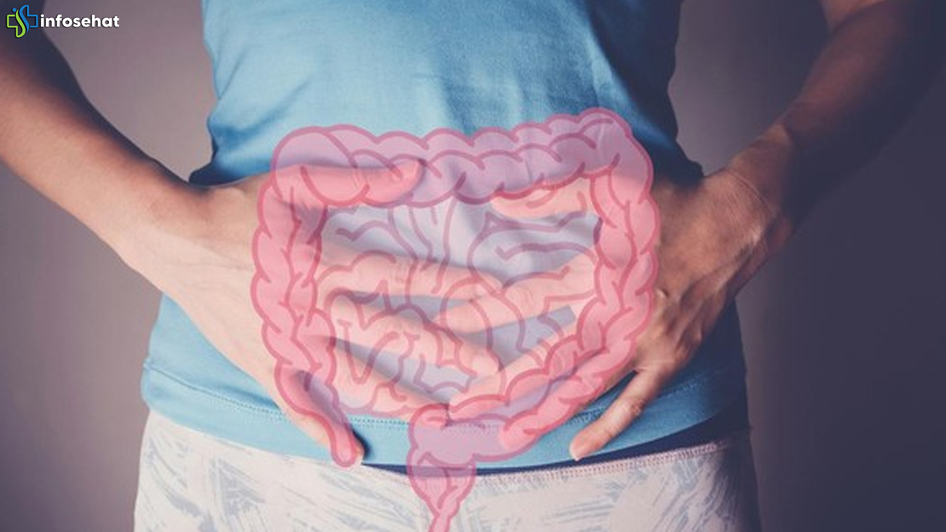 Nakes 33 Tahun Sangka Sembelit, Ternyata Kanker Rektum