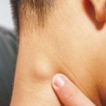 Waspada Benjolan di Leher, Mungkin Itu Tanda Kanker Limfoma