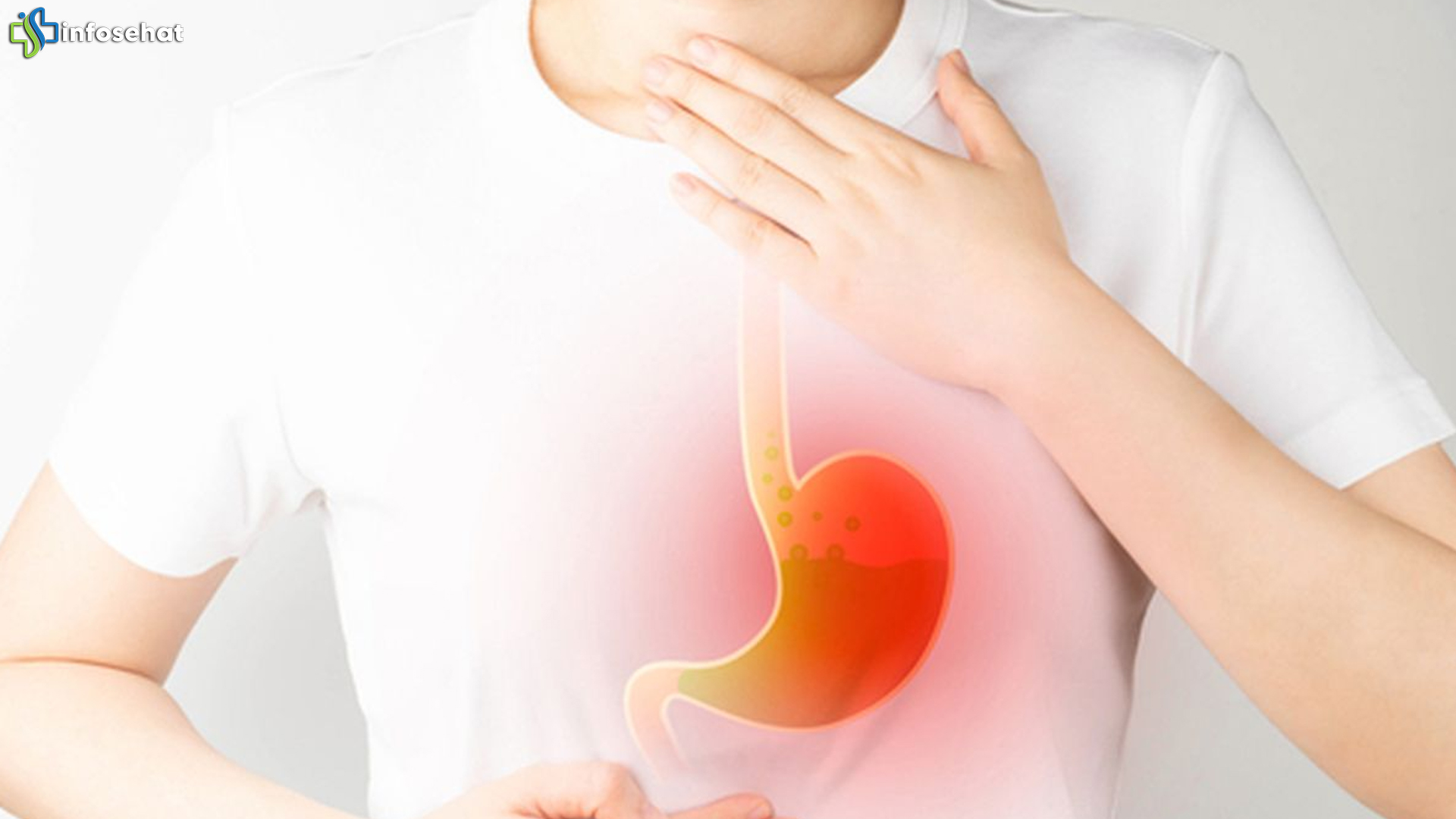 Obat GERD di Indonesia: Hasil Uji Klinis yang Bikin Optimis