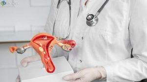 Pap Smear dan Vaksin HPV, Kunci Utama Lawan Kanker Serviks