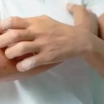 4 Masalah Kulit dengan Bercak Tak Biasa yang Berbahaya