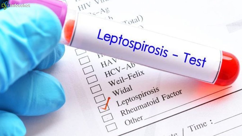 Leptospirosis Langka dan Gagal Ginjal Akut pada Pemuda Iran