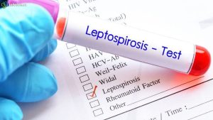 Leptospirosis Langka dan Gagal Ginjal Akut pada Pemuda Iran