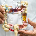 Gejala Radang Usus Buntu 4 Tanda dari Nyeri Perut Sampai Diare