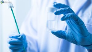 Manfaat 5 Langkah Tes Pap Smear Gratis Pakai BPJS Kesehatan