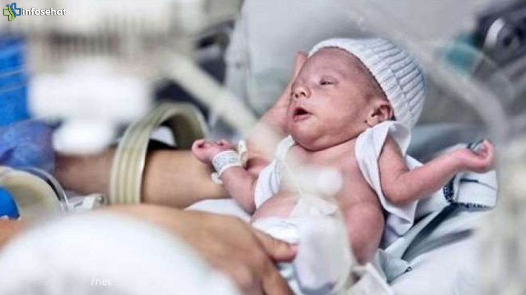 Ibu Hamil Tak Sehat, Risiko Bayi Prematur Melonjak 2025