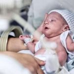 Ibu Hamil Tak Sehat, Risiko Bayi Prematur Melonjak 2025