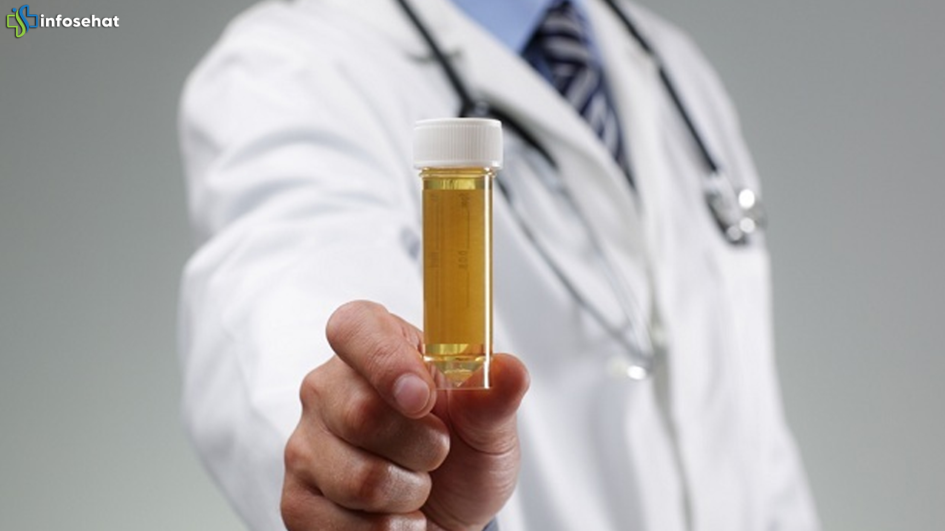 Menelusuri 4 Hubungan Warna Urine dan Risiko Demensia