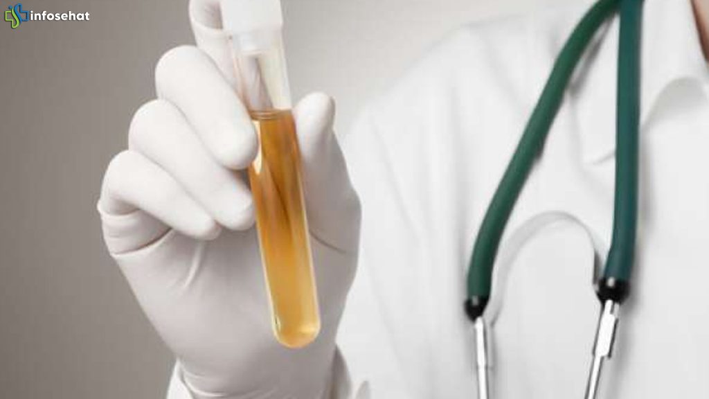 Menelusuri 4 Hubungan Warna Urine dan Risiko Demensia