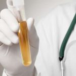 Menelusuri 4 Hubungan Warna Urine dan Risiko Demensia