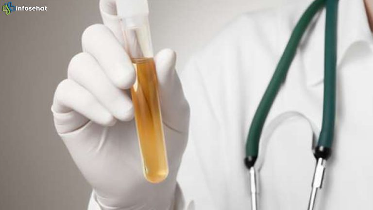 Menelusuri 4 Hubungan Warna Urine dan Risiko Demensia