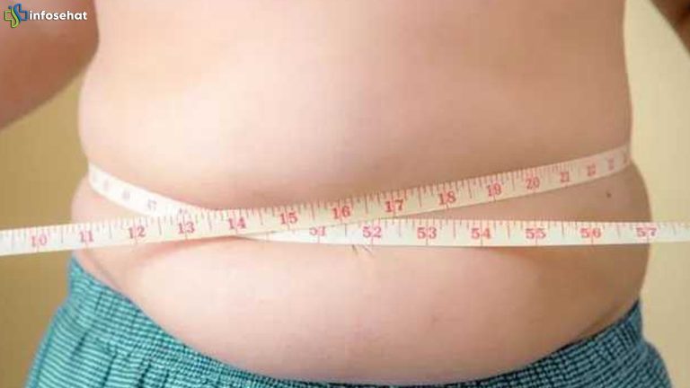 Remaja Obesitas Disorot, 4 Fakta Penting Baru dari UNICEF