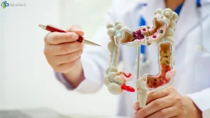 Gejala Kanker Usus Besar 5 Perubahan Feses yang Perlu Waspada