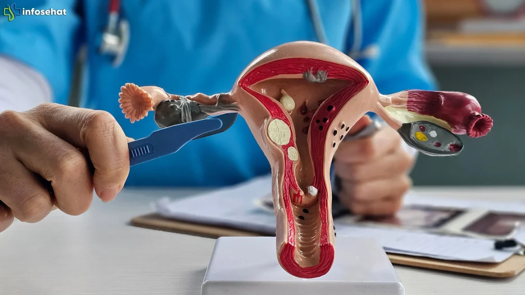 5 Alasan Cewek Harus Rajin Cek Kesehatan Rahim Biar Gak Kaget