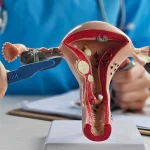 5 Alasan Cewek Harus Rajin Cek Kesehatan Rahim Biar Gak Kaget