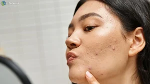 Kolesterol Naik? Jangan Anggap Remeh 2 Tanda di Wajah Ini