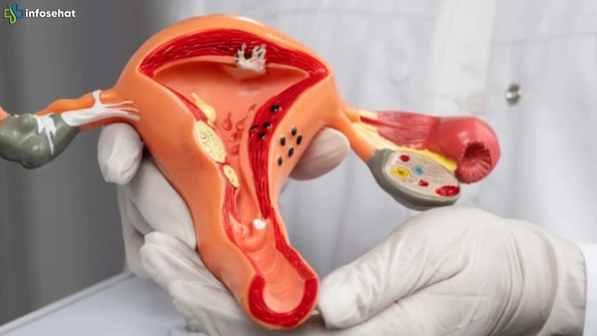 5 Alasan Cewek Harus Rajin Cek Kesehatan Rahim Biar Gak Kaget