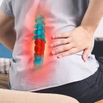 5 Gejala Penting Nyeri Punggung Karena Lemahnya Otot Bokong