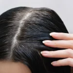 Studi Ilmiah: Tumbuh Uban Cepat Naikkan Risiko Kanker 30%, Ini Alasannya