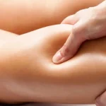 Dokter Ingatkan 5 Bahaya Memijat Kaki Pegal Karena Varises