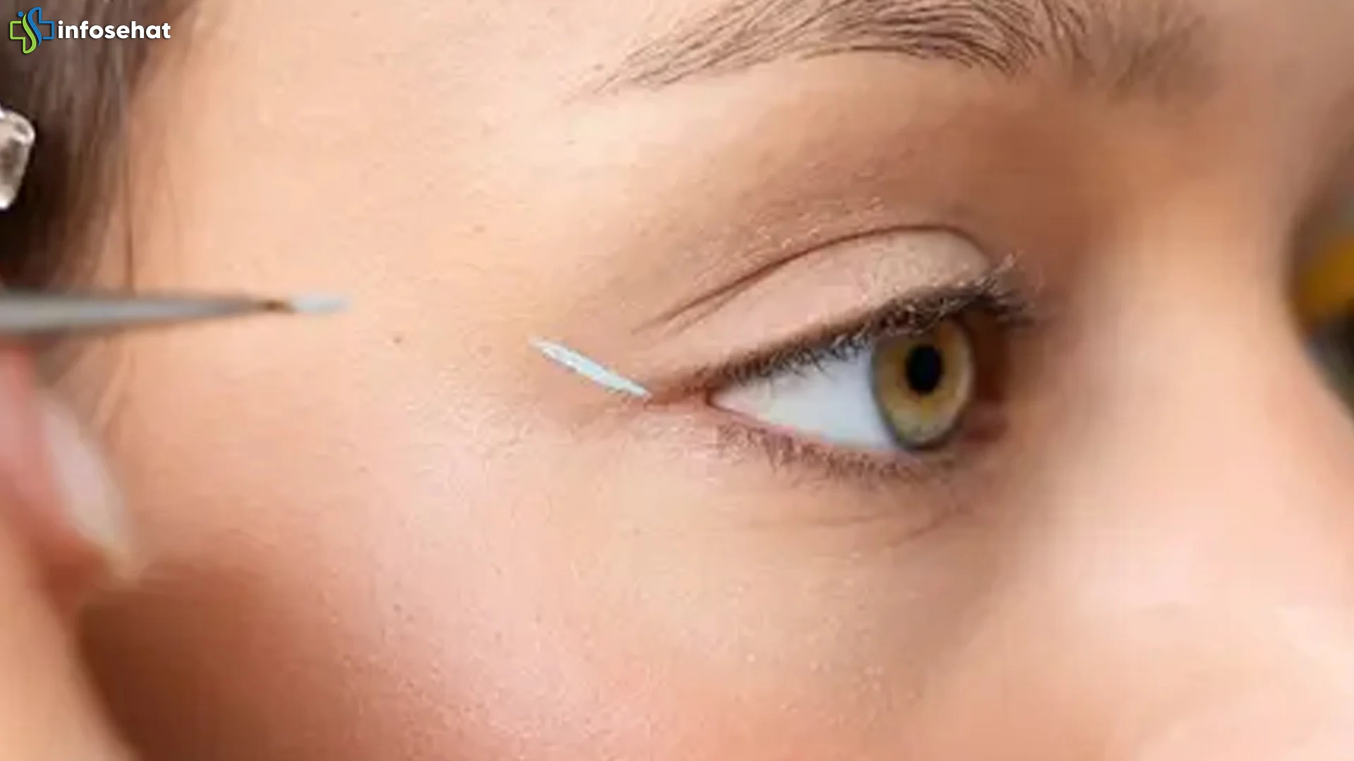 5 Cara Efektif Mengatasi Ptosis Agar Mata Tampak Segar Kembali