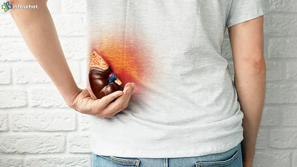 5 Situasi Batu Ginjal Yang Membutuhkan Penanganan Medis Cepat