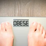 61 Risiko Penyakit Kronis Mengintai Orang Dengan Obesitas Tinggi