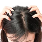 Rambut Bersih 5 Tidak Cukup Jika Masih Ada Kebiasaan Undang Kutu