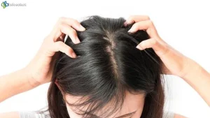 Rambut Bersih 5 Tidak Cukup Jika Masih Ada Kebiasaan Undang Kutu