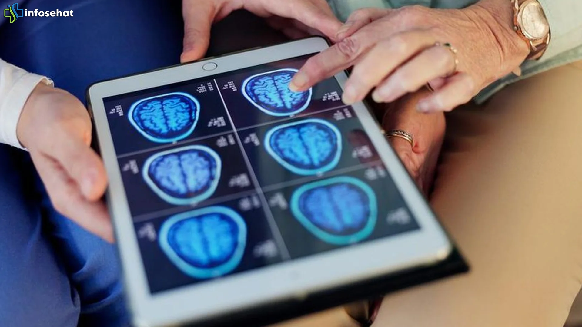 Gejala Kesemutan Ternyata 10 Tumor di Otak Wanita Baru Terungkap